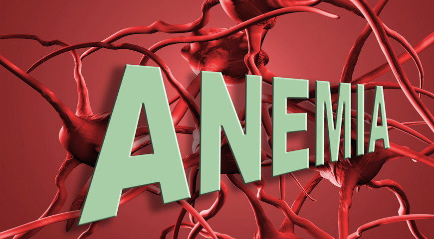 Anemia