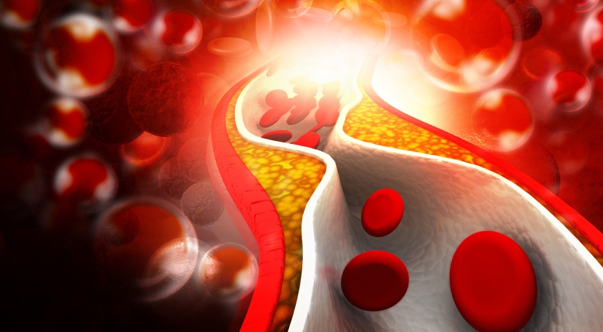 Nie taki cholesterol straszny jak go malują