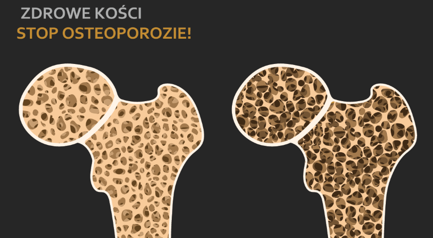 Ochrona przed osteoporozą