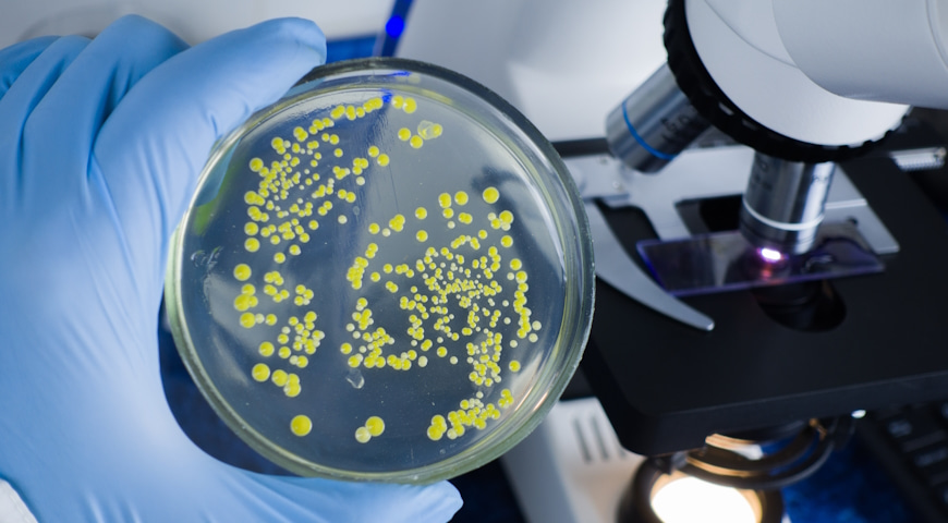 Enterococcus faecium – bakteria o dwóch twarzach. Sojusznik mikrobiomu czy zagrożenie zdrowia