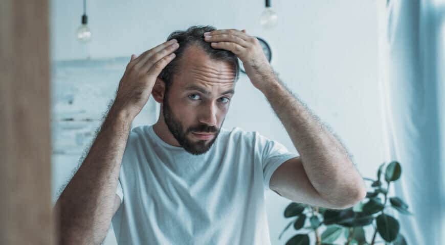 Łysienie_androgenowe_mito-med.pl