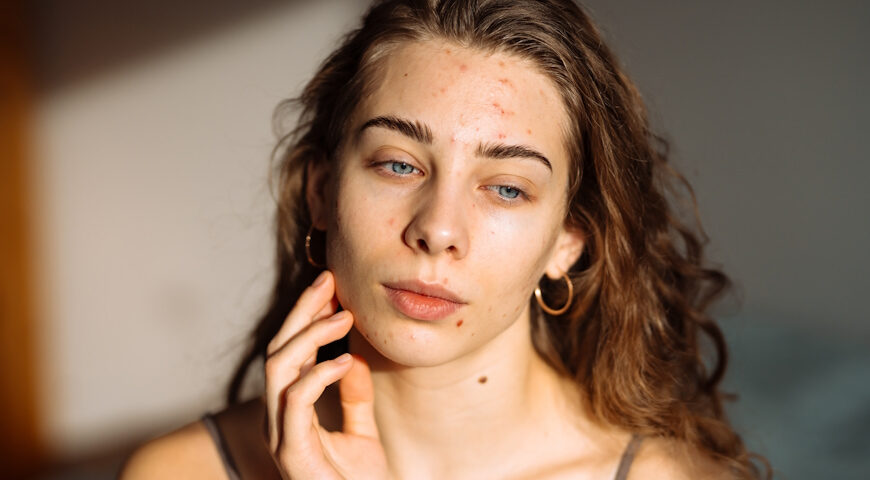 Cynk-i-jego-właściwości-pielęgnacja-a-suplementacja